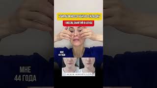 УБИРАЕМ НОСОГУБНЫЕ СКЛАДКИ