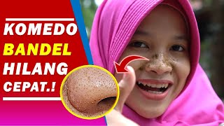 Cara Menghilangkan Komedo Hitam atau Putih yang Bandel di Hidung dengan Cepat