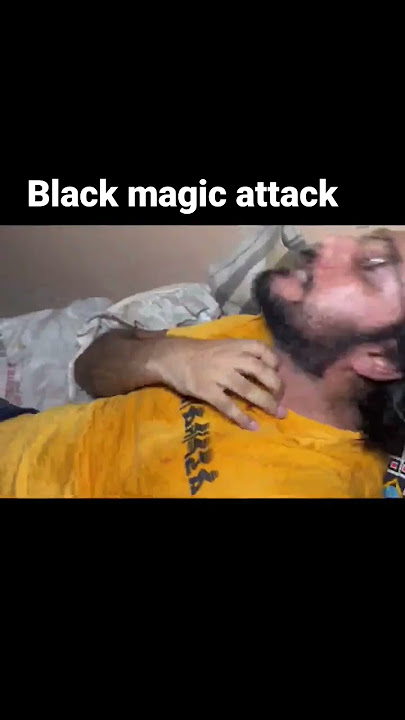black magic attack #shorts #shortvideo