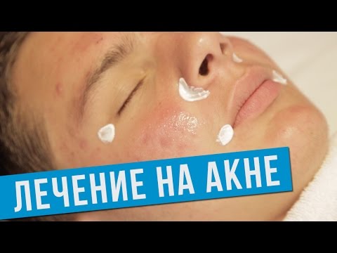 Лечение на Акне - Д-р Весела Райкова - Aesthe Clinic Beauty