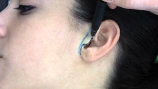 Pittsburgh Facial Plastic Surgeon Dr. Leong discusses the Facelift Incision in front of the Ear