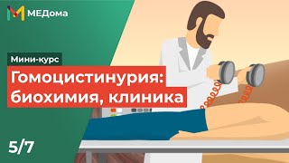 ГОМОЦИСТИНУРИЯ - причины, симптомы, патогенез, диагностика, лечение / USMLE step 1 5/7 | Медома