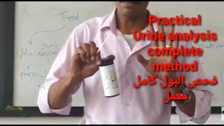 Urine analysis complete methodفحص البول كاملا مع الشرح المفصل د. سامي خويطر #سامى_حسن_خويطر