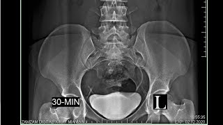 Intervenes Pylography I V U Test Renal Study By Zam Zam Digital X-Ray Mianwali