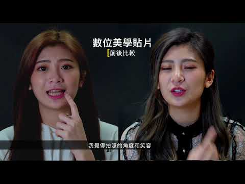 【美白貼片 微笑曲線】真美之星💎-咪雅Mia │ 真美牙醫診所