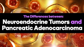 Spotting the Differences between Neuroendocrine Tumors and Pancreatic Adenocarcinoma