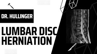 Lumbar Disc Herniation w/ Dr. Hullinger (Pt 1)
