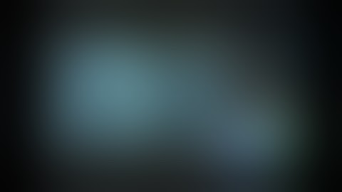 MIS TLIF - 3 D Navigated