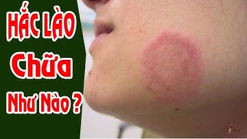 Hắc Lào, Lác Là Gì? Thuốc trị  dứt điểm hắc lào, lác đồng tiền?