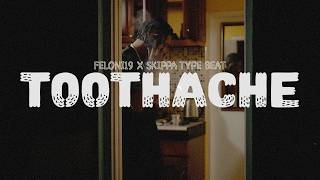 Feloni19 x Skippa Dancehall Type Beat “Toothache” | 2026 Riddim Instrumental @MVGBEATS ​
