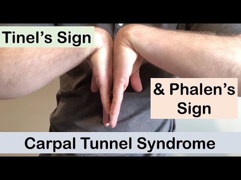 Carpal tunnel syndrome | Tinel’s sign and Phalen’s sign | Clinical Examination