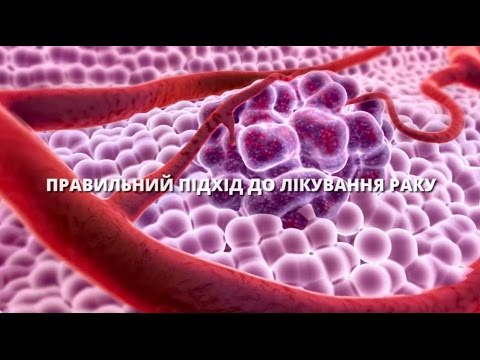 Правильный подход к лечению рака