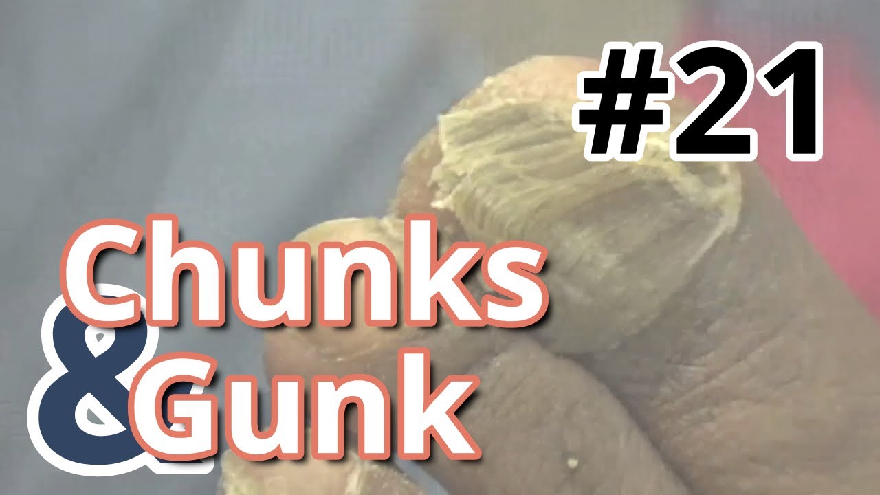 Chunks and Gunk 22 Another Big Toe (2023) YouTube
