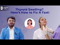 Thyroid Problems in Women | Neck Swelling - Dr. Rohit Madhurkar | Doctors' Circle