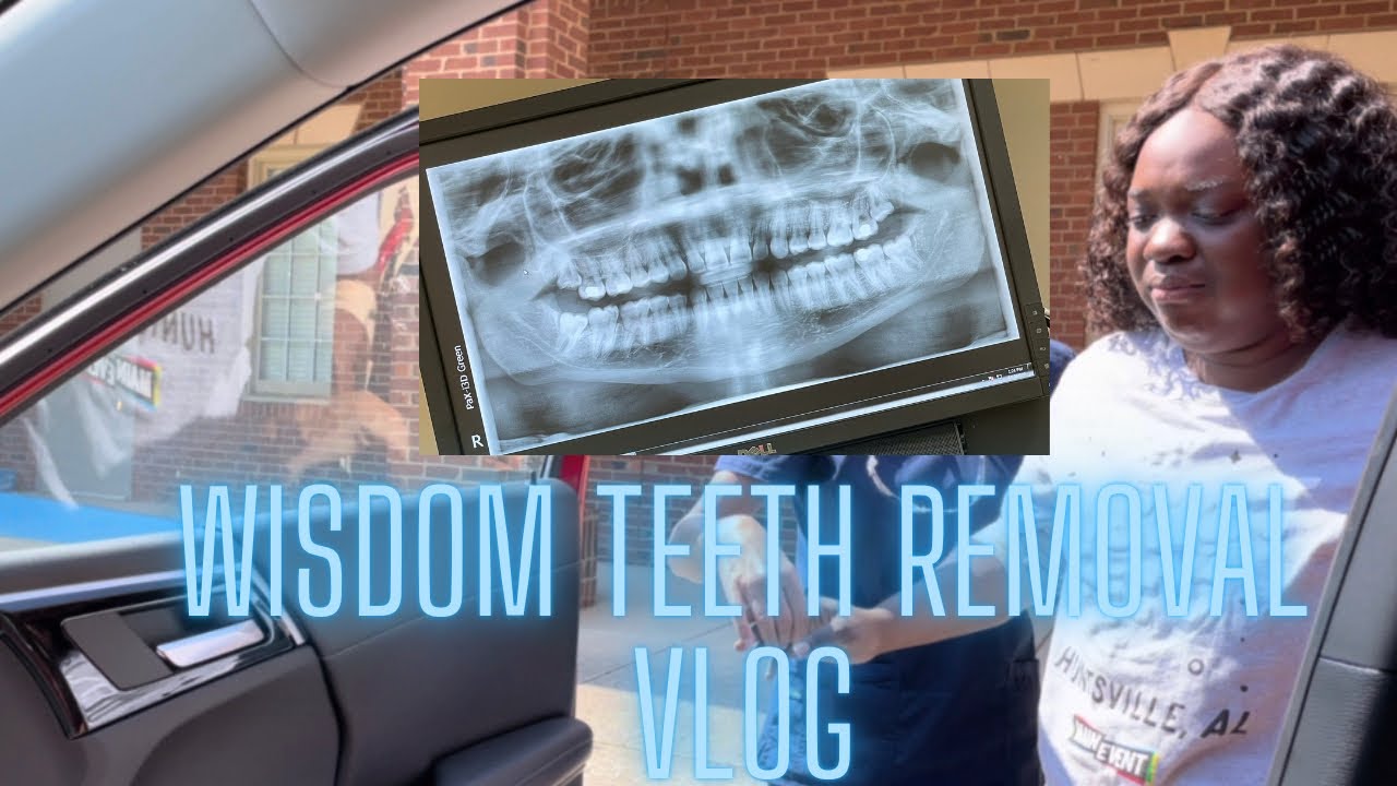 WISDOM TEETH REMOVAL VLOG - YouTube