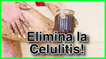 ¿Cómo puedo revertir la celulitis de forma natural?