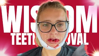 git my wizdum teef re mooved wiff me (funny wisdom teeth removal)