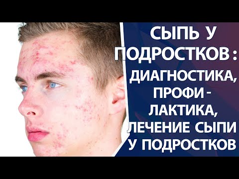 Сыпь у подростков