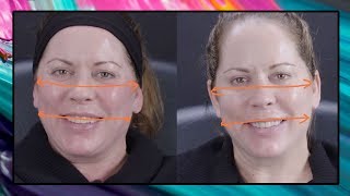 In this week’s video i discuss how can use fillers to make your face
look slimmer. plus, my segment of ‘i’m not getting paid say
this,’ show you tw...