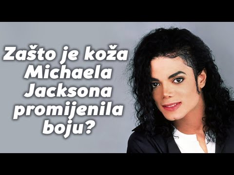 Zašto je koža Michaela Jacksona promijenila boju?