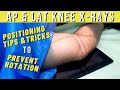 How to do routine knee xrays ap  lateral  ask the rad tech