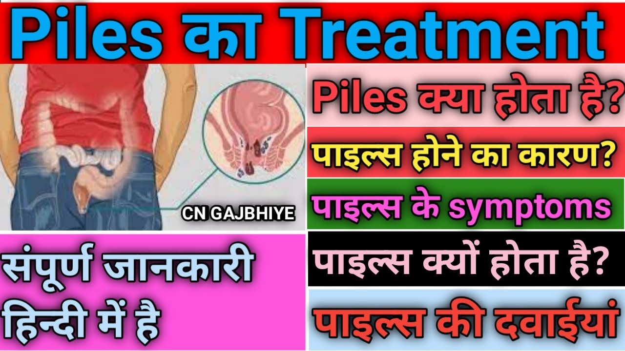 PILES KA TREATMENT PILES KI MEDICINE PILES RELIEF MEDICINE PILES piles-ka-treatment-piles-ki-medicine-piles-relief-medicine-piles