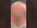 3-Monats-Special 😎🔥 Das ist der Daily Hair  Growth-Progress im zweiten Monat 🤙 bleibt gespannt 👀