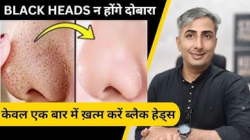 चेहरे के Blackheads, Whiteheads, Open Pores व दाग धब्बों से 100% छुटकारा पाएं | DR. MANOJ DAS