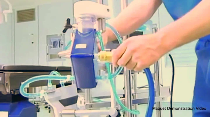 ECMO Therapy: An Advanced Form of Life Support That Saves Lives