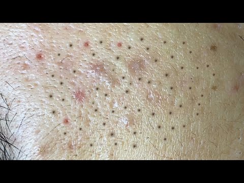 Satisfying Relaxing with Sac Dep Spa Video (#150)