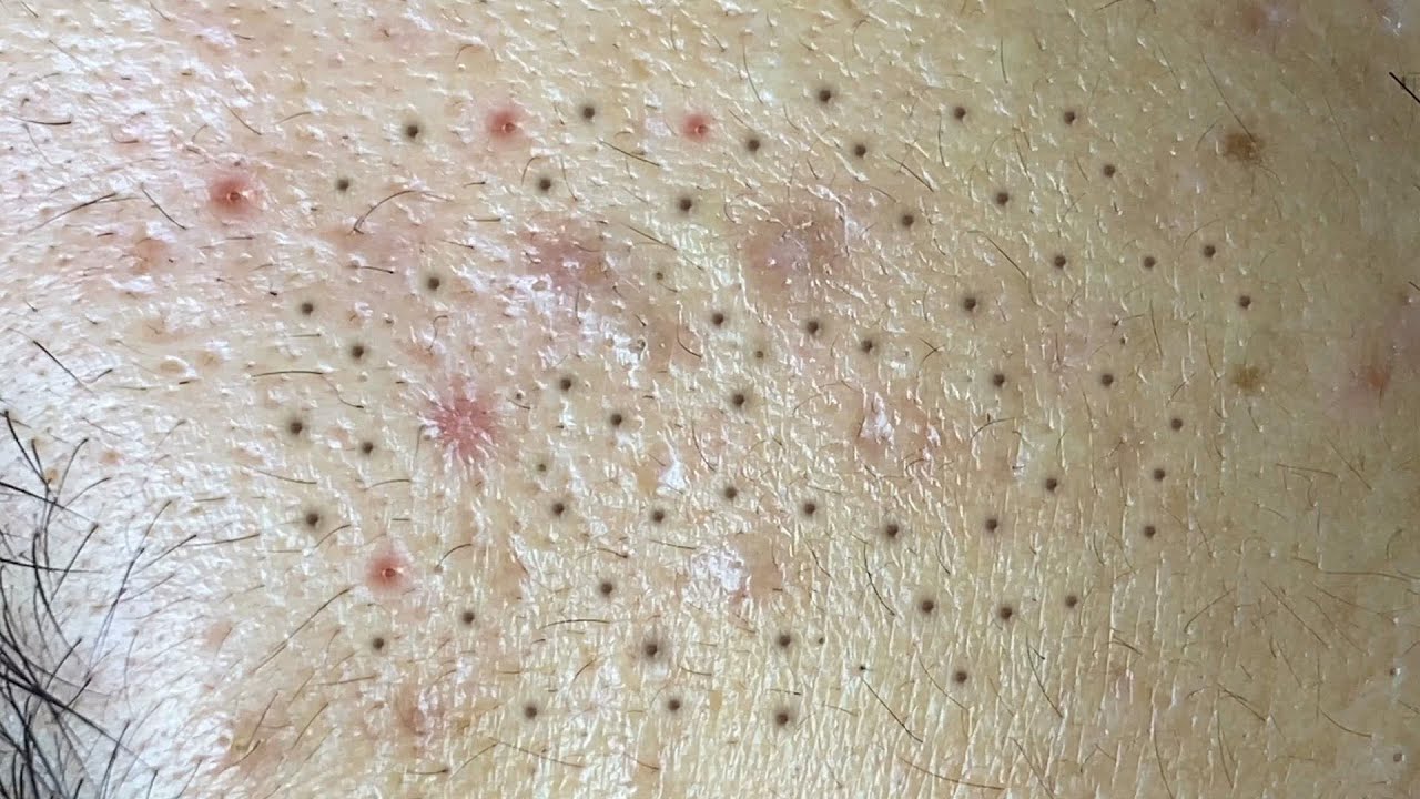 Satisfying Relaxing with Sac Dep Spa Video (#150)