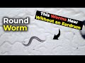 Round Worm | This Worms Hear Without an Eardrum!
