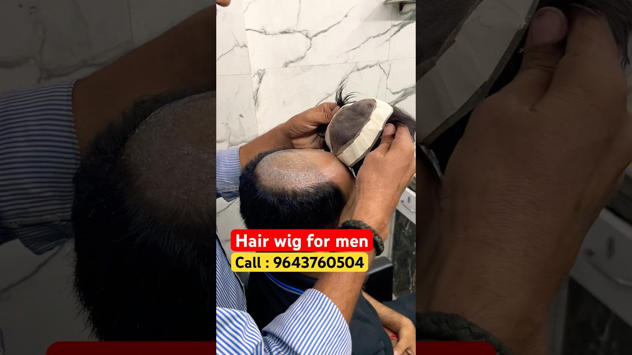 Hair wig for men | non surgical hair treatment in india 