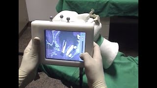 NaviView - Augmented Reality in the OR (2002)