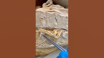 Look Where the Spinal Cord Ends!