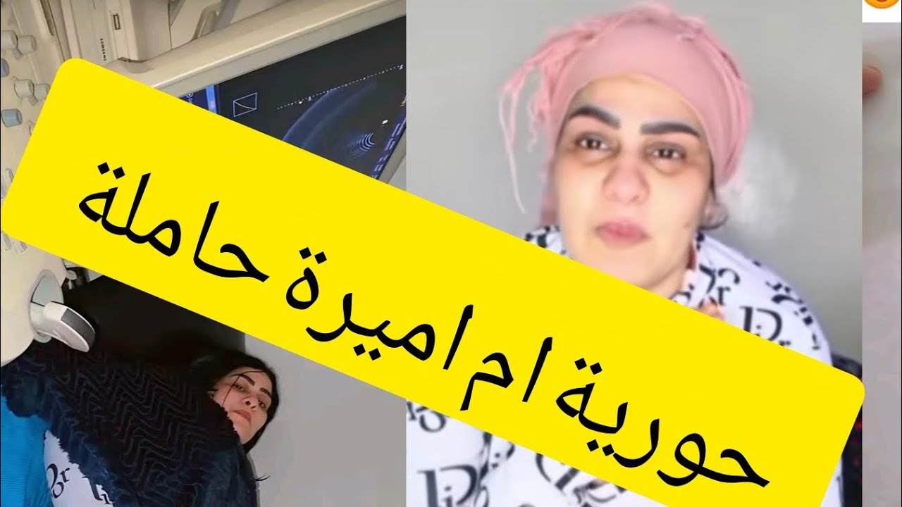 حورية ام اميرة حاملة وليوم غادي تعاود قتصها كاملة صراحه كتبكي مسكينة الله يثبت حملها 🥺😭