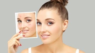 चेहरे के कील मुंहासों को करे खत्म ।मात्र 7 दिन में। how to remove acne pimples . Sabrang Ayurved