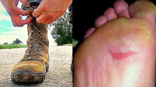 Rucking Foot Care | Blisters & Pain