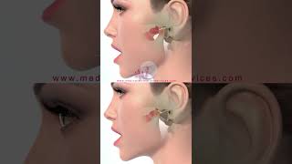 Jaw Snap animated video  | 3d medical animation