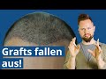 Können Grafts wirklich wieder ausfallen? Haartransplantation Türkei