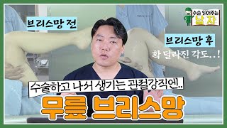 브리스망이 위험하다고?｜무릎 브리스망 케이스｜수술 읽어주는 남자👨‍⚕️