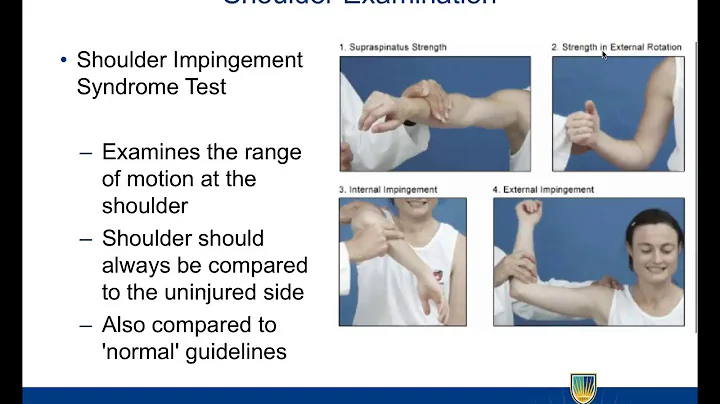What are the most common musculoskeletal disorders? (2023)