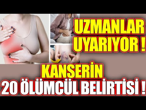 Kanserin 20 ölümcül belirtisi Bu Belirtiler Varsa Kanser Olabilirsiniz