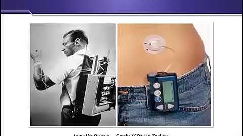 Designing Smart Medical Devices with Force Sensing Technology