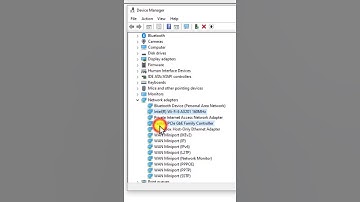 Ethernet connected but no internet access FIXED ( 2025 ) | no internet access but connected