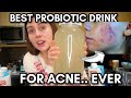 The Best Drink You Can Consume For Your Skin || Clear acne fast, look more refreshed and glowy!
