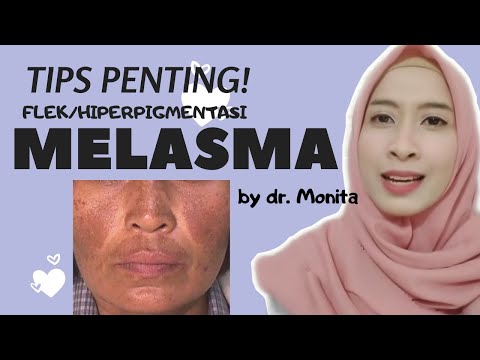 Video: Cara Menghilangkan Sunless Tanner dari Kulit: 12 Langkah (dengan Gambar)