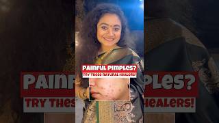 Painful Pimples? Try These Natural Remedies | #pimple #skincare