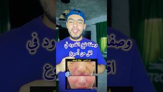 وصفة نفخ الخدود في اقل من أسبوع screenshot 2