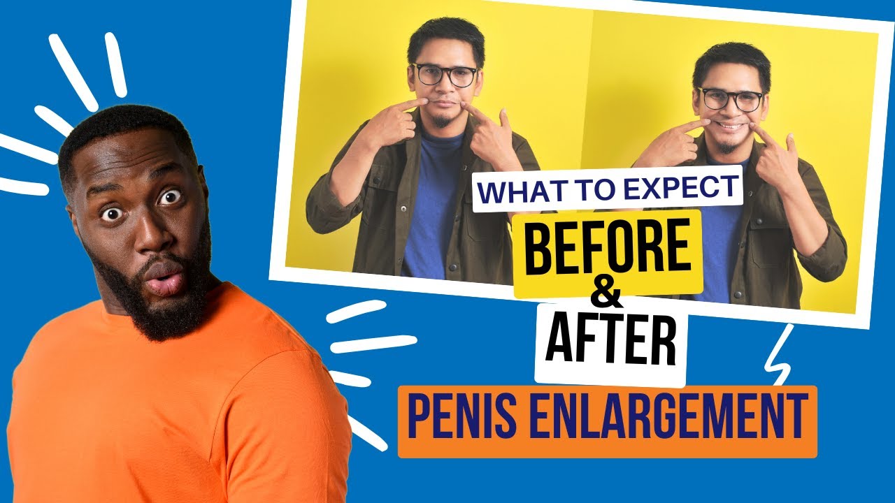 Penis Enlargement Before And After Photos